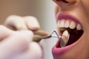 O que é periodontite